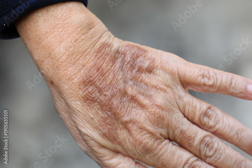 ging hands aging hands aging hands showing wrinkles and age spots, elderly hands, senior skin texture, aging process, healthcare and aging society concept