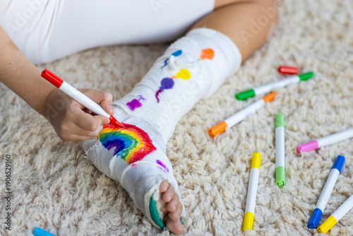 Photos Child decorating leg cast with colorful markers while sitting on carpet
