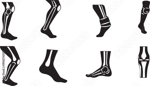 Anatomical illustrations of human legs showcasing skeletal and muscular structures in black and white.