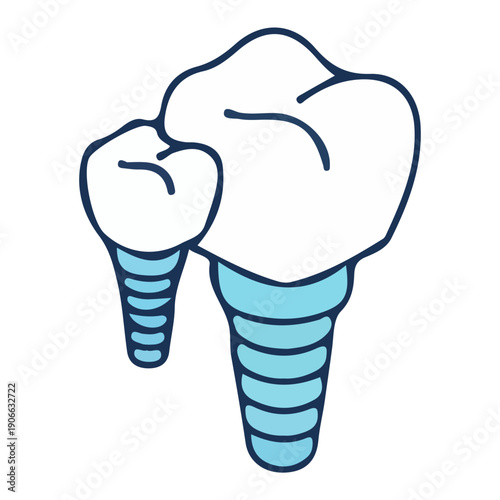 Hand Drawn Dental Implant Illustration