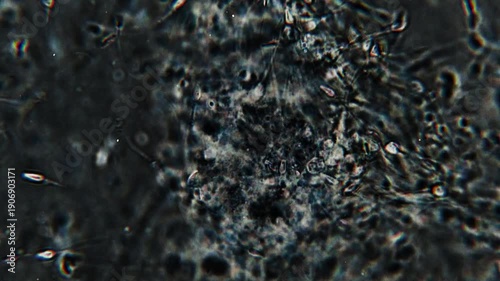 Real footage of human sperm under a light microscope 100x fertilizing an egg cell moving fast dark field microscope 4K HQ 