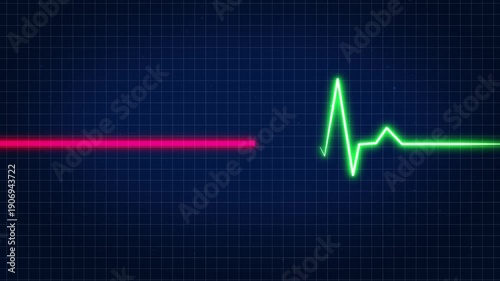 Heart Failure, Life Stopping, Medical Emergency, Health Crisis, Cardiac Arrest, And Critical Care Concepts. Medical Animation of a Green Heartbeat Wave Transitioning Into A Straight Red Flatline.