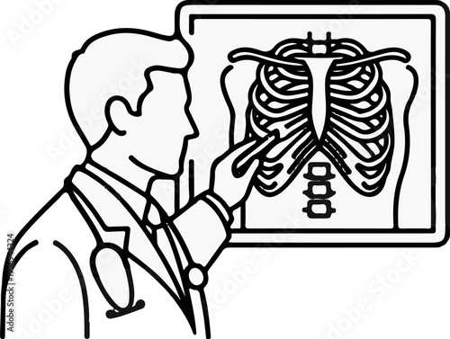 Medical professional examining an X-ray of human rib cage and spine