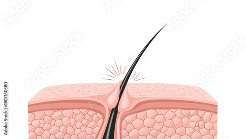 Scientific illustration showing a single hair follicle growing through layers of human skin with detailed cell structure.