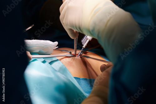 Surgical Procedure with Retractors Holding Skin During Operation