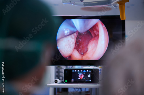 Doctor Reviewing Trachea Endoscopy Image on Medical Screen