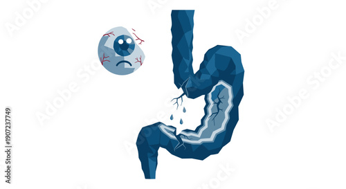 A broken and leaky intestine with a sad eyeball, illustrating digestive problems, gut health issues, or leaky gut syndrome.