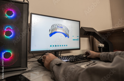 Dental CAD software showing 3D crown model on screen, digital dentistry, orthodontic planning, prosthetics design process in modern dental laboratory.