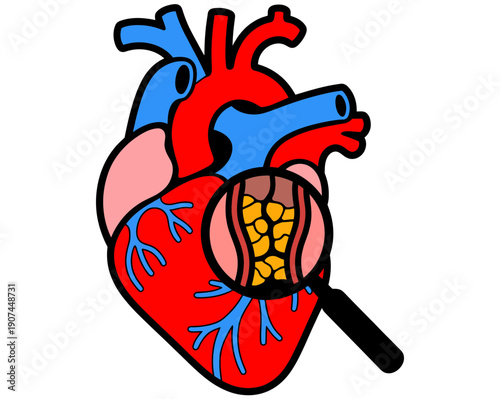 A medical illustration of a human heart with a magnifying glass highlighting the inner workings of the organ