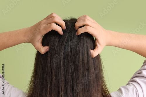 Photos Young woman with dandruff problem scratching head on green background, back view