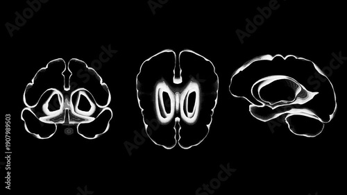 Neural interfaces of the future. Animation of brain structures. Visualization of brain waves for biohacking.