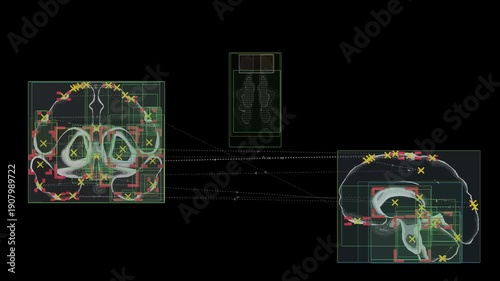 Neural cross-connections. Marker visualization. Quantum neural routes. Analysis of active areas of the brain.