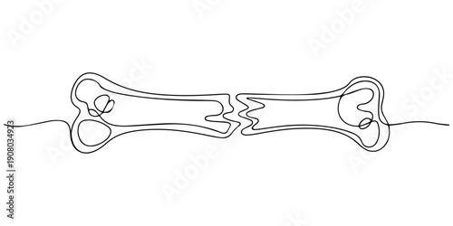 One line fracture. Abstract minimal continuous line, A broken bone in one continuous line one line vector illustration Editable stroke, Broken Bone Anatomy Fracture Human. Broken bone icons for Graph.