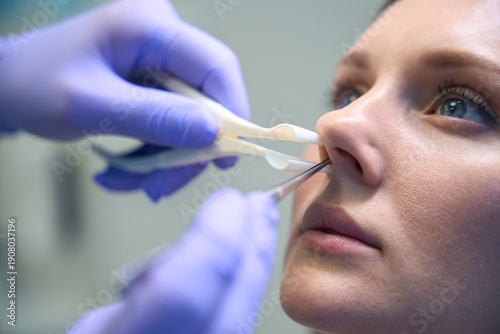 Schilderij op canvas Otorhinolaryngologist checking nose with otoscope of female patient at clinic