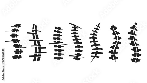Spinal Column Variations: Scoliosis, Lordosis, Kyphosis, Straight Spine - Medical Illustration