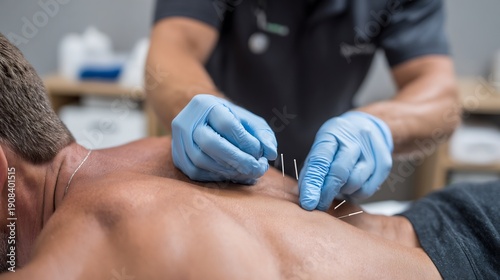 Bild auf Leinwand Martial artist performing dry needling therapy muscle tension physiotherapist ap