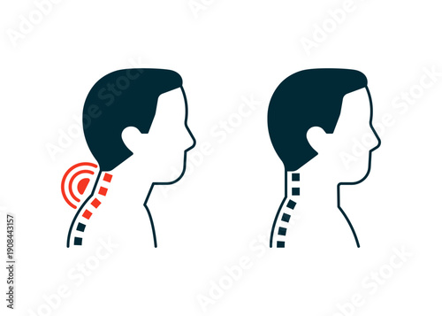 Man with neck pain and good posture. Illustration comparing bad posture causing pain and correct posture for spine health concept. Vector illustration