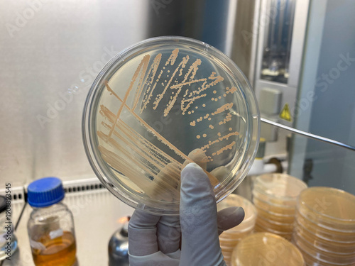 Bacterial colony growth on agar plate in laboratory. Macro shot of colorful microbial colonies on Petri dish. Bacillus is colony.
