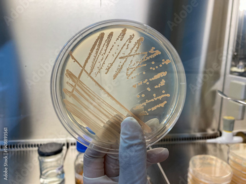 Bacterial colony growth on agar plate in laboratory. Macro shot of colorful microbial colonies on Petri dish. Bacillus is colony.
