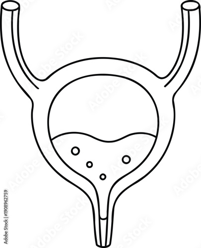 Illustration of the female reproductive system with uterus, fallopian tubes, and ovaries
