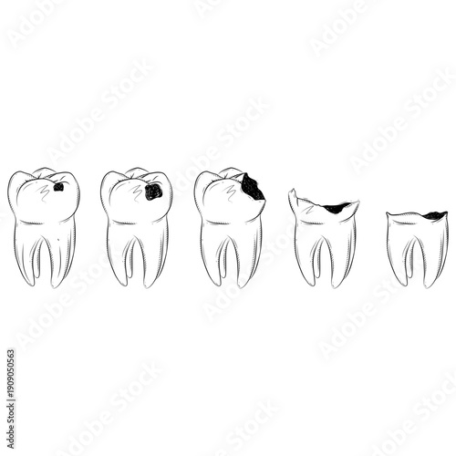 Lifecycle of Tooth Problems – Dental Health Illustration
