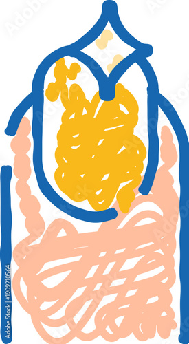Fingernail showing an infectious condition with yellowed and thickened appearance, representing a common problem in dermatology and podiatry requiring treatment and care