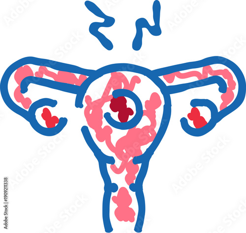 Uterus illustration showing internal pathology like endometriosis or other gynecological inflammation, causing discomfort and pain indicated by distress symbols