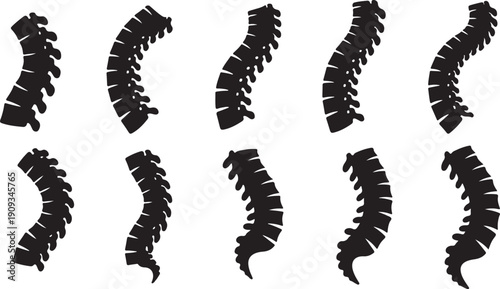 Spine anatomy illustrations in various curved positions shown
