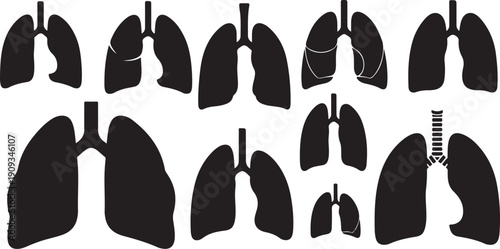 Human lungs anatomy and various lung conditions illustrations