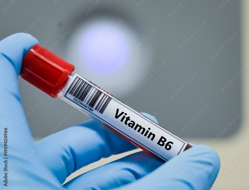 Obraz premium Blood sample tube for vitamin B6 test analysis.