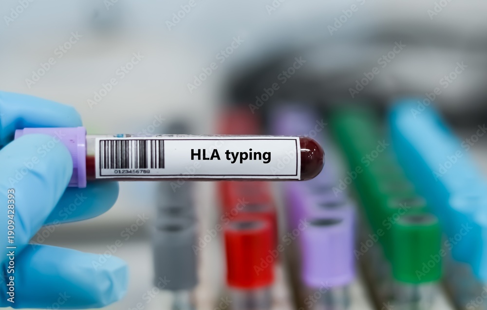 Obraz premium Blood sample tube for HLA typing test analysis.