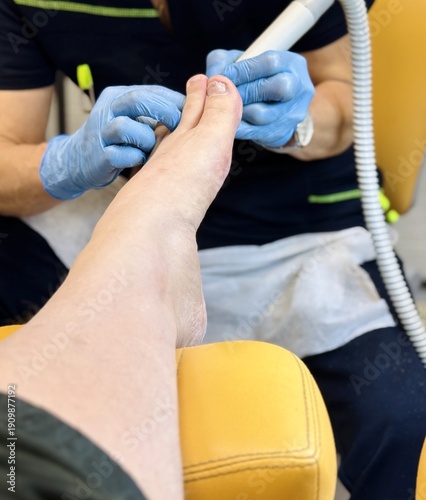 Close-up foot pedicure with electric file, podiatrist wearing blue gloves performs hardware debridement of thick fungal toenails in clinical salon, diabetic foot precautions observed, sterile.