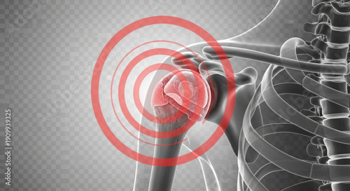 A medical illustration of a human skeleton with a red pain symbol over the shoulder joint on a transparent background