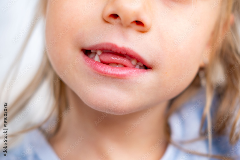 Fototapeta premium happy positive funny toothless 6-year-old girl, Close-up smiling child's face, showcasing missing baby teeth and joyful expression, waiting for toothfairy, innocence, growth, and childhood milestones