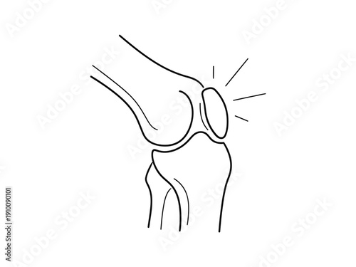 Minimalist line drawing of a human knee joint, illustrating anatomy and potential joint pain.