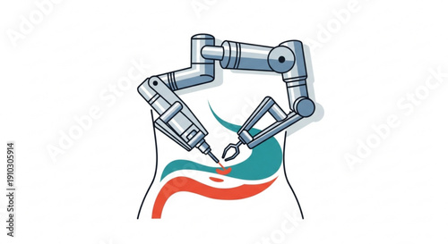 Robot arm performing surgery on human body illustration with mechanical precision and futuristic technology in modern medical procedure