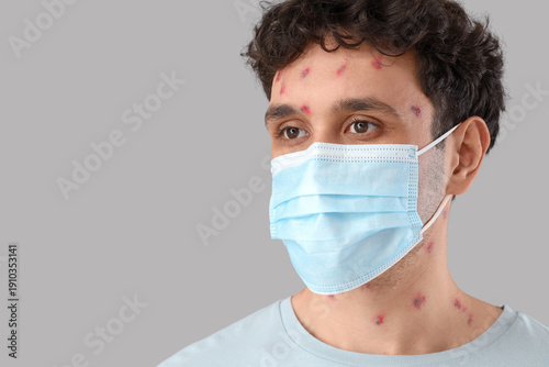 Young man ill with chickenp...