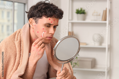 Ill young man with mirror a...