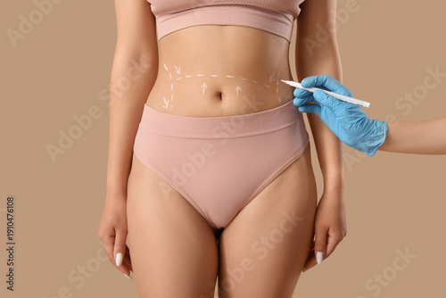 Tableau sur toile Plastic surgeon marking woman's belly on beige background, closeup