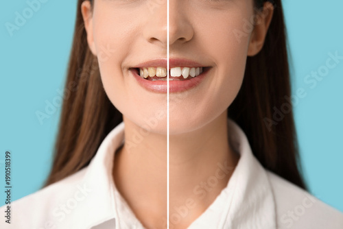 Young woman with diastema smiling on blue background, closeup