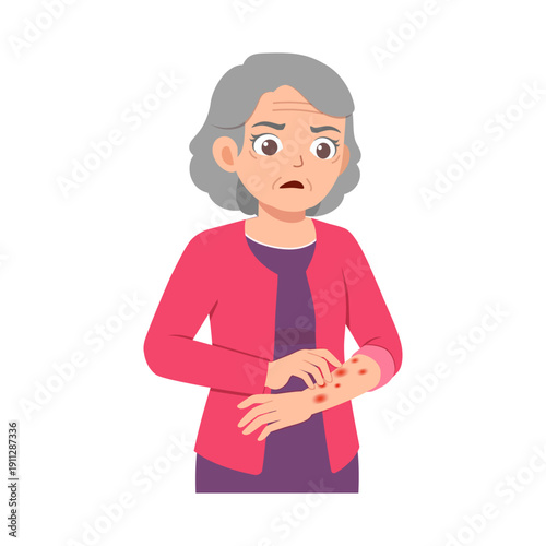 Worried senior woman scratching itchy red rashes on her arm feeling discomfort and irritation