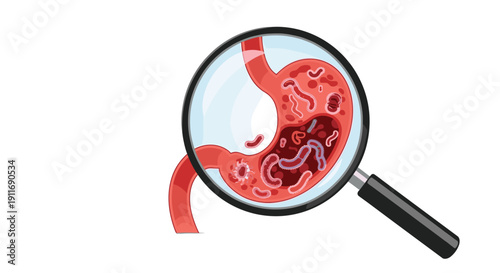 Human stomach seen through a magnifying glass revealing parasitic worms and infections for medical diagnosis and digestive health education.