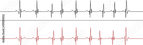 Electrocardiogram heartbeat waveform set in black and red representing medical pulse monitoring vector illustration