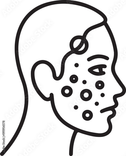 acne on skin face icon, pimple inflammation, dermatology or skincare, block pores problem, clean dermis, wrinkle mask, one line Art icon drawing.