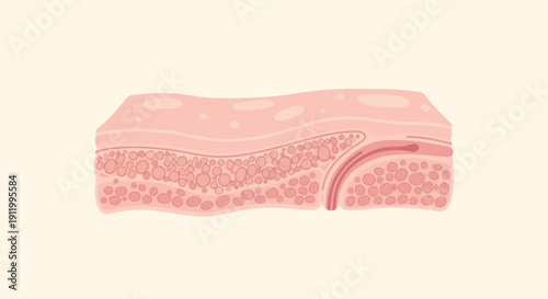 Stylized diagram of skin layers and fat tissue