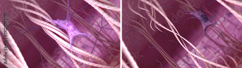 Cuadro en lienzo Simile of the fibroblasts, collagen, and elastin fibers in young and aged skin
