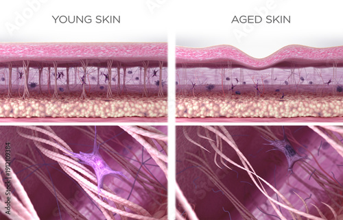 Fotografia Simile of collagen fibers in young and aging wrinkled skin