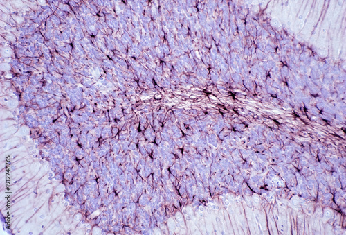 Quadro su tela Cerebellum. GFAP