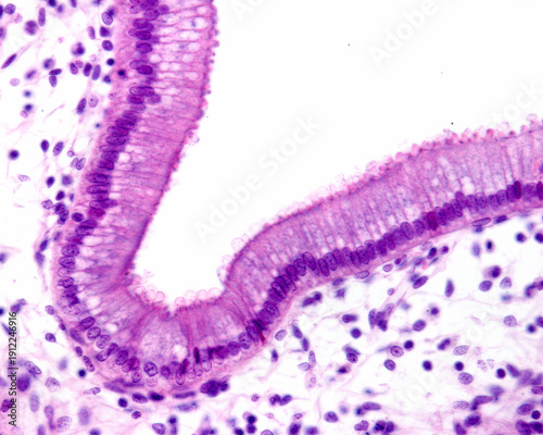 Foto Gallbladder. Simple columnar epithelium