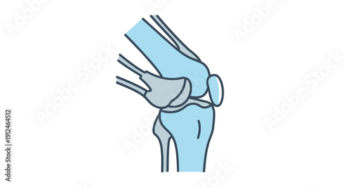 Knee Joint Dislocation Illustration
